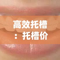 高效托槽：托槽价格 