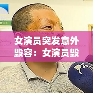 女演员突发意外毁容：女演员毁容的鼻子毁了整张脸的 