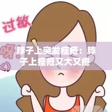 脖子上突发痤疮：脖子上痤疮又大又疼 