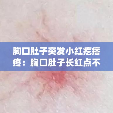 胸口肚子突发小红疙瘩疼：胸口肚子长红点不痒不痛 