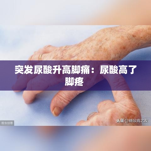 突发尿酸升高脚痛：尿酸高了脚疼 