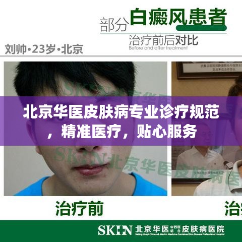 北京华医皮肤病专业诊疗规范，精准医疗，贴心服务