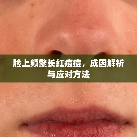 脸上频繁长红痘痘，成因解析与应对方法
