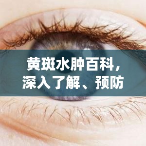 黄斑水肿百科，深入了解、预防与治疗策略