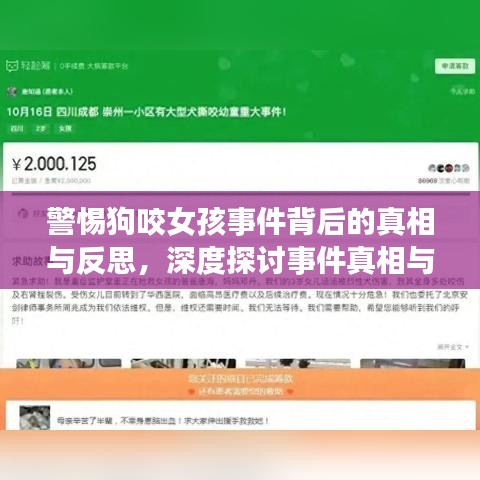 警惕狗咬女孩事件背后的真相与反思，深度探讨事件真相与警示社会关注