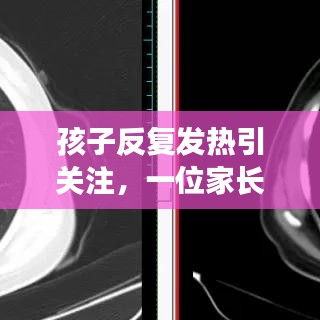 孩子反复发热引关注，一位家长的深度剖析与探讨